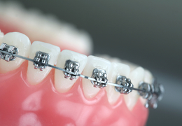 Ортодонтия в стоматологии Пульс во Фрязино